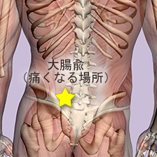 腸が原因の腰痛の場所