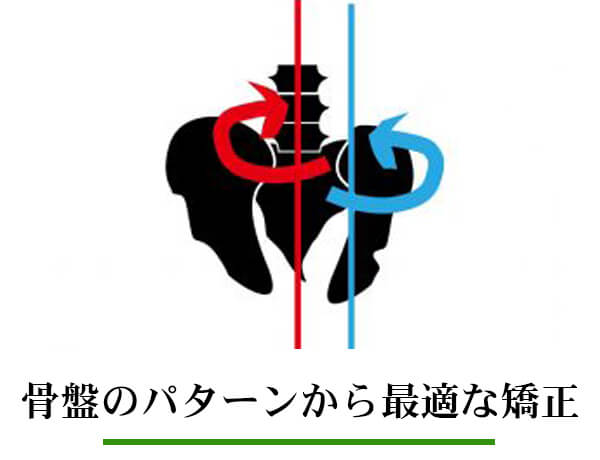 骨盤のパターンから最適な施術を