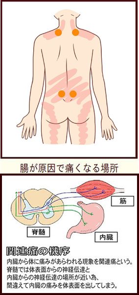 腸が原因で肩こりや腰痛が起こる 大阪 梅田の整体 腸もみ 首痛や背中痛 腰痛 肩こり 胃もたれ 便秘 下痢 腹部膨満感 ガス 胃もたれにお悩みなら 整体サロントータルバランスover