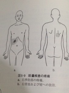 内科診断学関連痛