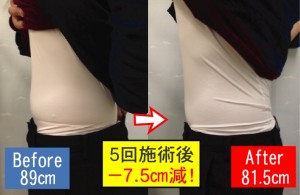 ダイエットモニター男性びふぉあふ完成