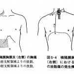 腸が原因の首こり肩こり