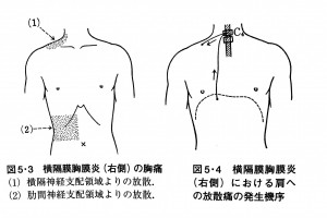 腸が原因の首こり肩こり