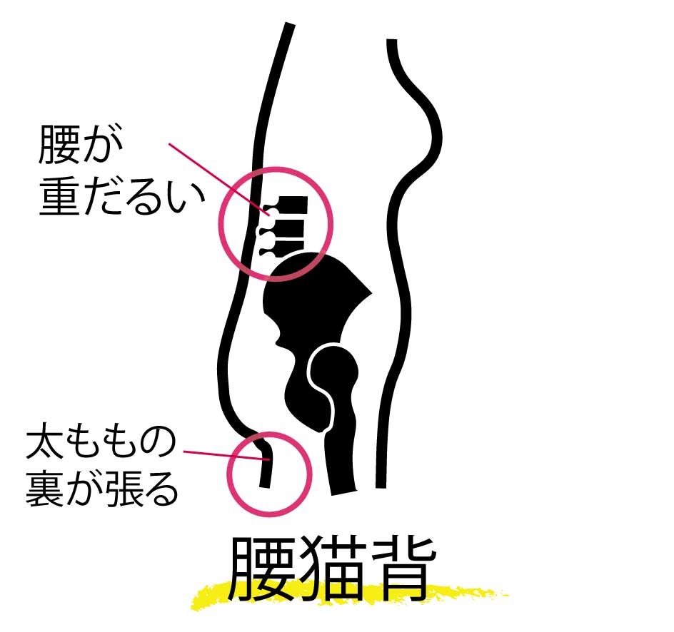 骨盤矯正,骨盤のズレ,腰の重だるさ,太腿裏の重だるさ,脚の重だるさ