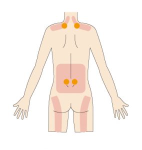 首痛,肩こり,背中の痛み,背中痛,腰痛,腰が重だるい,太ももの裏がだるい,小腸,大腸,腸