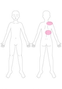 関連痛マップ 内臓が原因の身体の痛みの場所 大阪 梅田の整体 腸もみ 首痛や背中痛 腰痛 肩こり 胃もたれ 便秘 下痢 腹部膨満感 ガス 胃もたれにお悩みなら 整体サロントータルバランスover