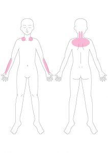 首の重だるさ,肩の重だるさ,背中の重だるさ,肺,呼吸が浅い