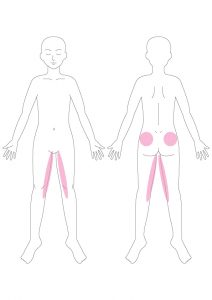 腰痛,お尻の痛み,太ももの内側の痛み,子宮,卵巣