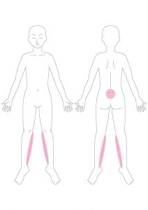 背中 胃 痛み もたれ の