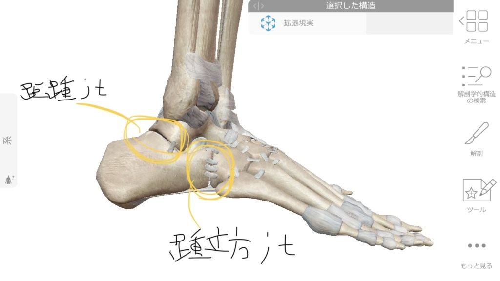 踵の痛みは関節のズレのこともある