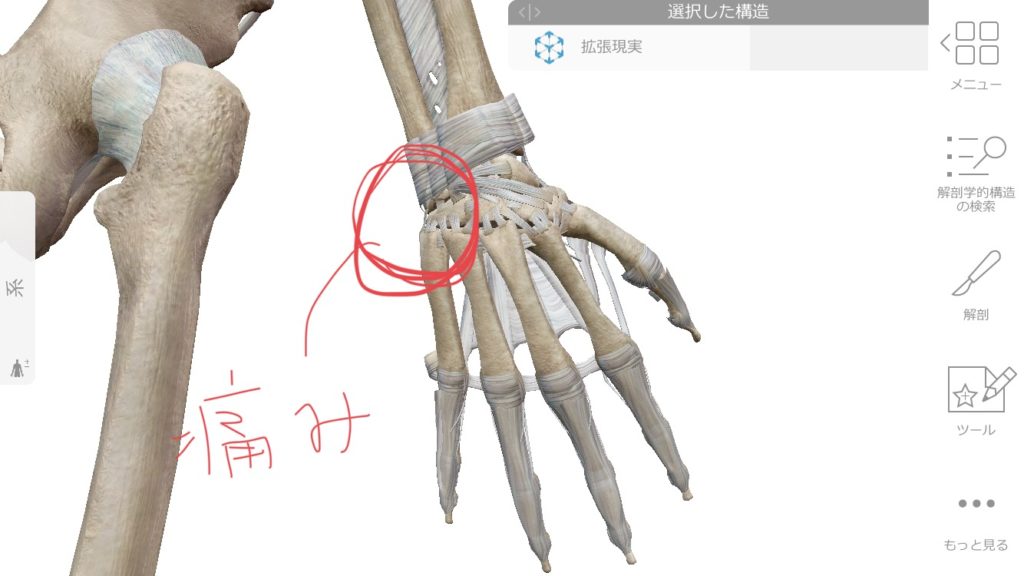 手首の小指側の痛み