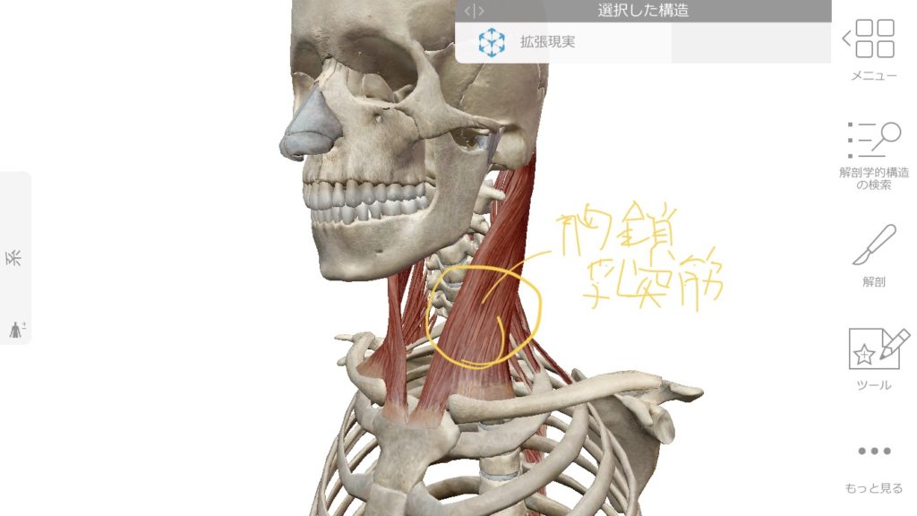 胸鎖乳突筋による目のぼやけ、目の奥の痛み