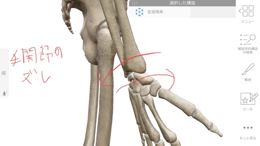 手首のズレによる痛み