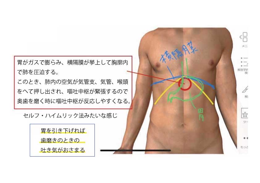 歯磨きのときの吐き気 えずき をおさえる方法 大阪 梅田の整体 腸もみ 首痛や背中痛 腰痛 肩こり 胃もたれ 便秘 下痢 腹部膨満感 ガス 胃もたれにお悩みなら 整体サロントータルバランスover