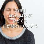 【症例】食いしばりがひどくて口が開けにくい状態